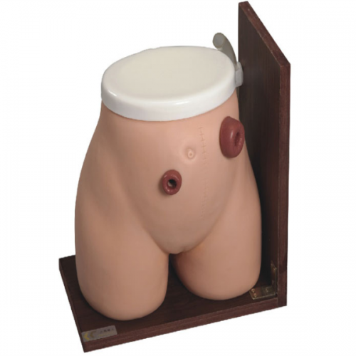 高級瘺管造口術(shù)護(hù)理模型